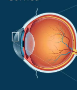 <p>What is the rectangle on</p>