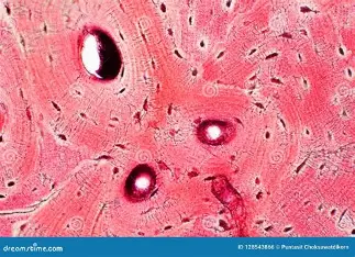 <p>Bone (Osseous Tissue)</p>