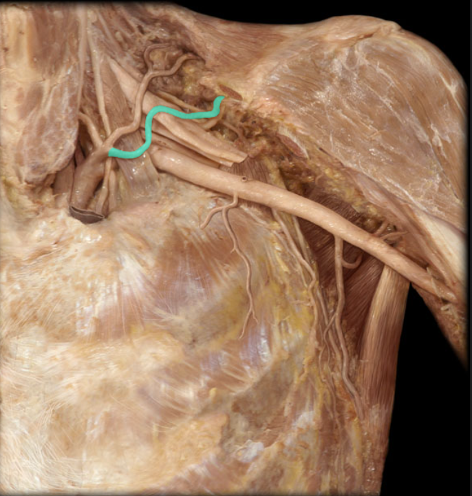 <ul><li><p><strong>Origin: </strong>Thyrocervical trunk or subclavian artery</p></li><li><p><strong>Course: </strong></p><ul><li><p>Passes across inferior neck towards scapula</p></li><li><p>Passes onto posterior aspect of scapula</p></li></ul></li><li><p><strong>Distribution:</strong></p><ul><li><p>Supra- and infraspinatus muscles</p></li><li><p>Acromioclavicular and glenohumeral joints</p></li></ul></li><li><p><strong>Comment:</strong></p><ul><li><p>Contributes to anastomoses around scapula</p></li><li><p>Anastomosis refers to the end-to-end union of vessels</p></li></ul></li></ul><p></p>