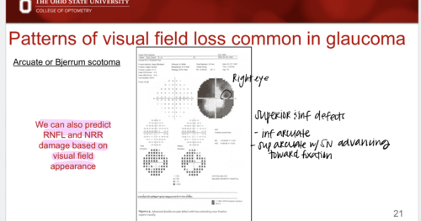 <p>True or False: </p><p>We can predict RNFL and NRR appearance and damage based on VF damage</p>