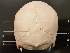 <p>What structure is #8? (Fig. 3.4 Cranium, Posterior View)</p>