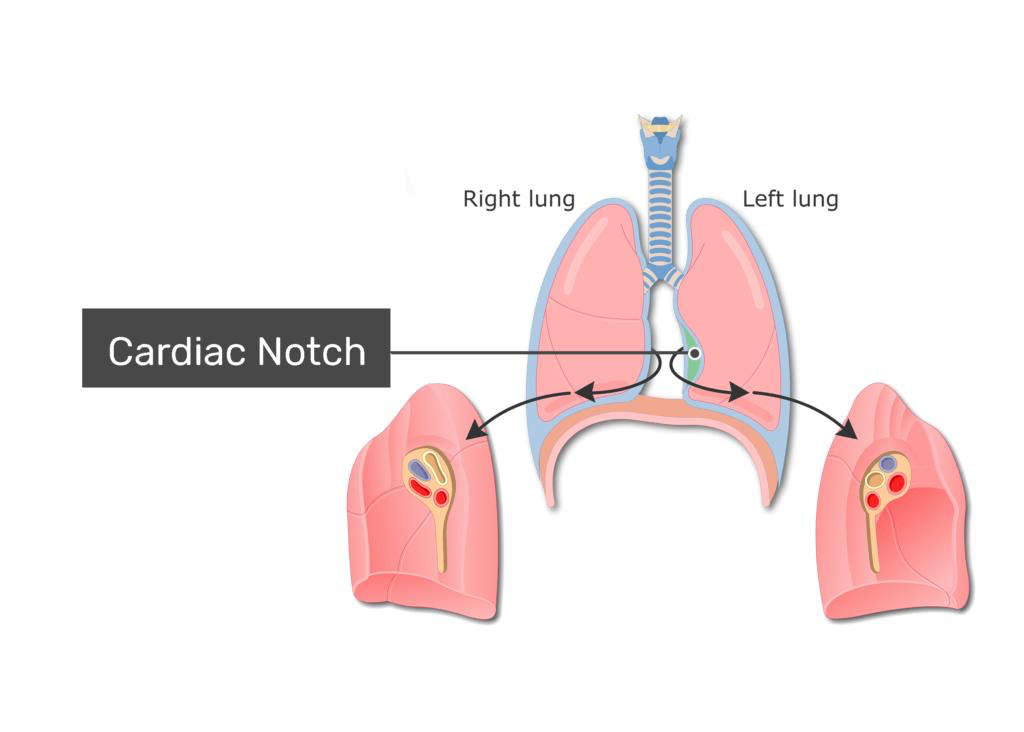 <p><span>The </span><strong>cardiac notch</strong><span> is a dent in the left lung where the heart sits. </span></p><p><span>Think of it as the lung "making room" for the heart.</span></p><p></p>