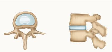 <p>What part of the vertebrae is this?</p>
