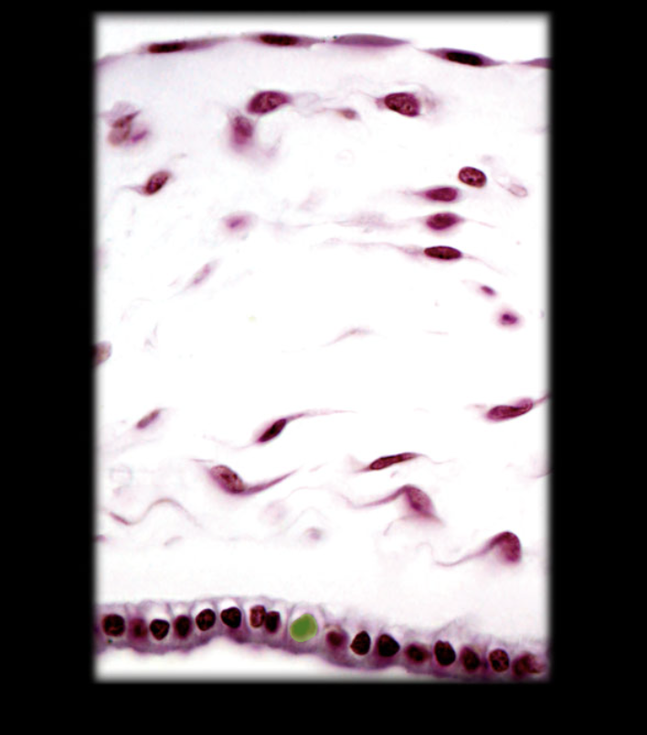 term image