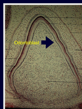 <p>-do we need to preserve the pulp?</p><p>-radiograph is answer</p><p>-mature root: remove pulp (no need to preserve)</p><p>-immature root: will arrest further development of dentin if removed (will be removing odontoblasts), want to preserve the pulp</p>