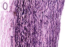 <p>In this image, the elastic fibers are stained black. which of the following best describes this type of vessel?</p>