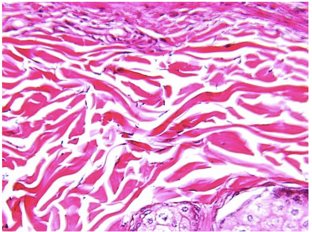 <p>What is this Connective Tissue? and where is it found ?</p>