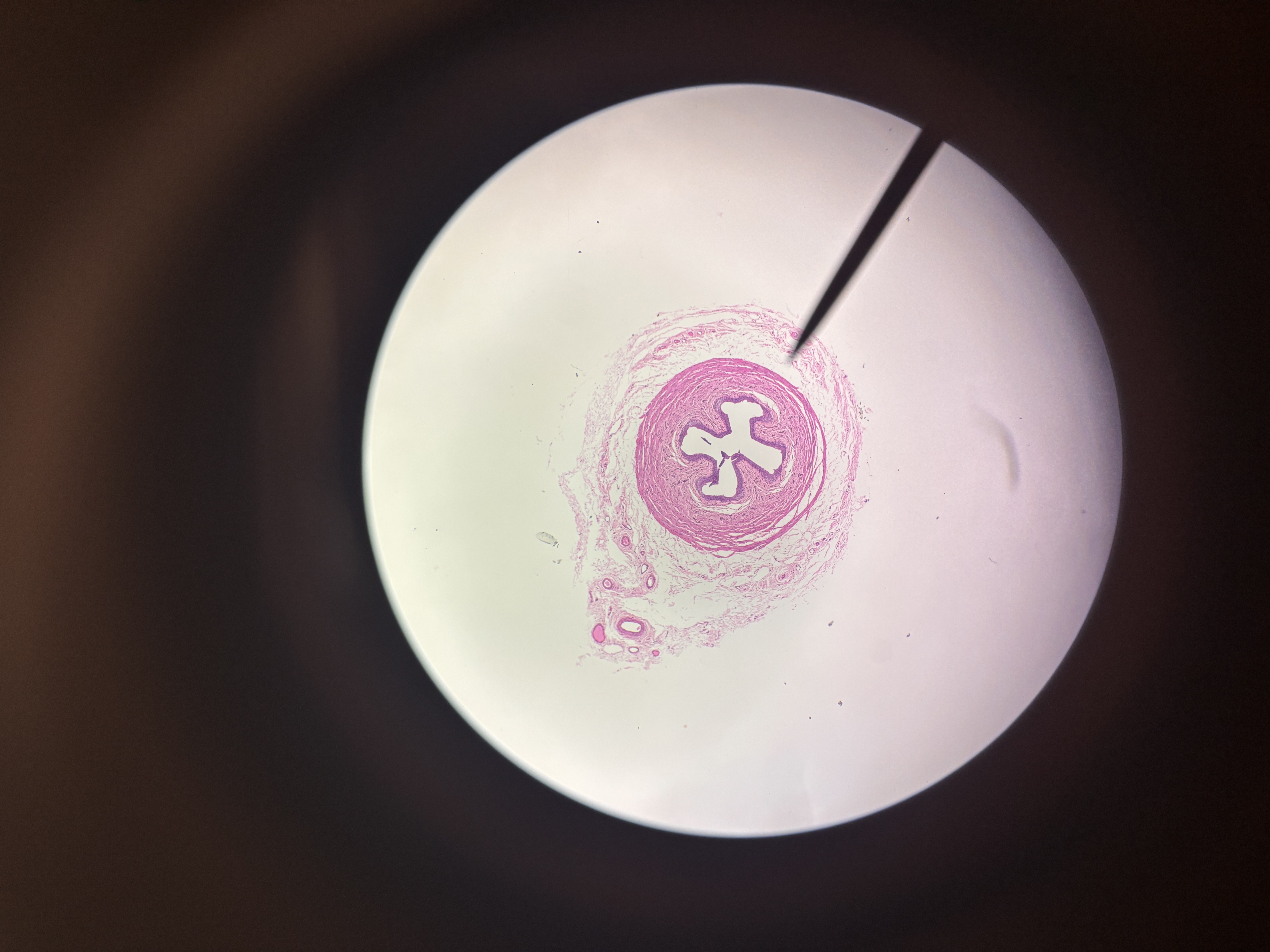<p>What slide is this?</p>