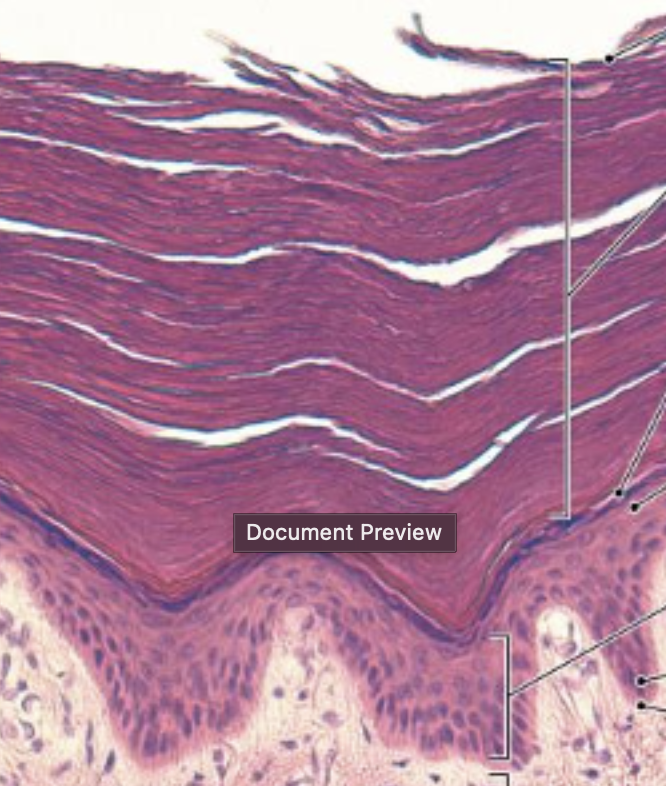 <p>layer that surrounds the. stratum spinosum very thinly </p>