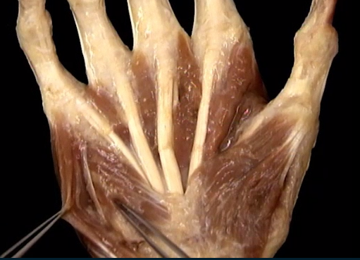 <p>Diep, Handpalm,</p>