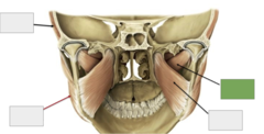 <p>Muscles of mastication: This is the</p>