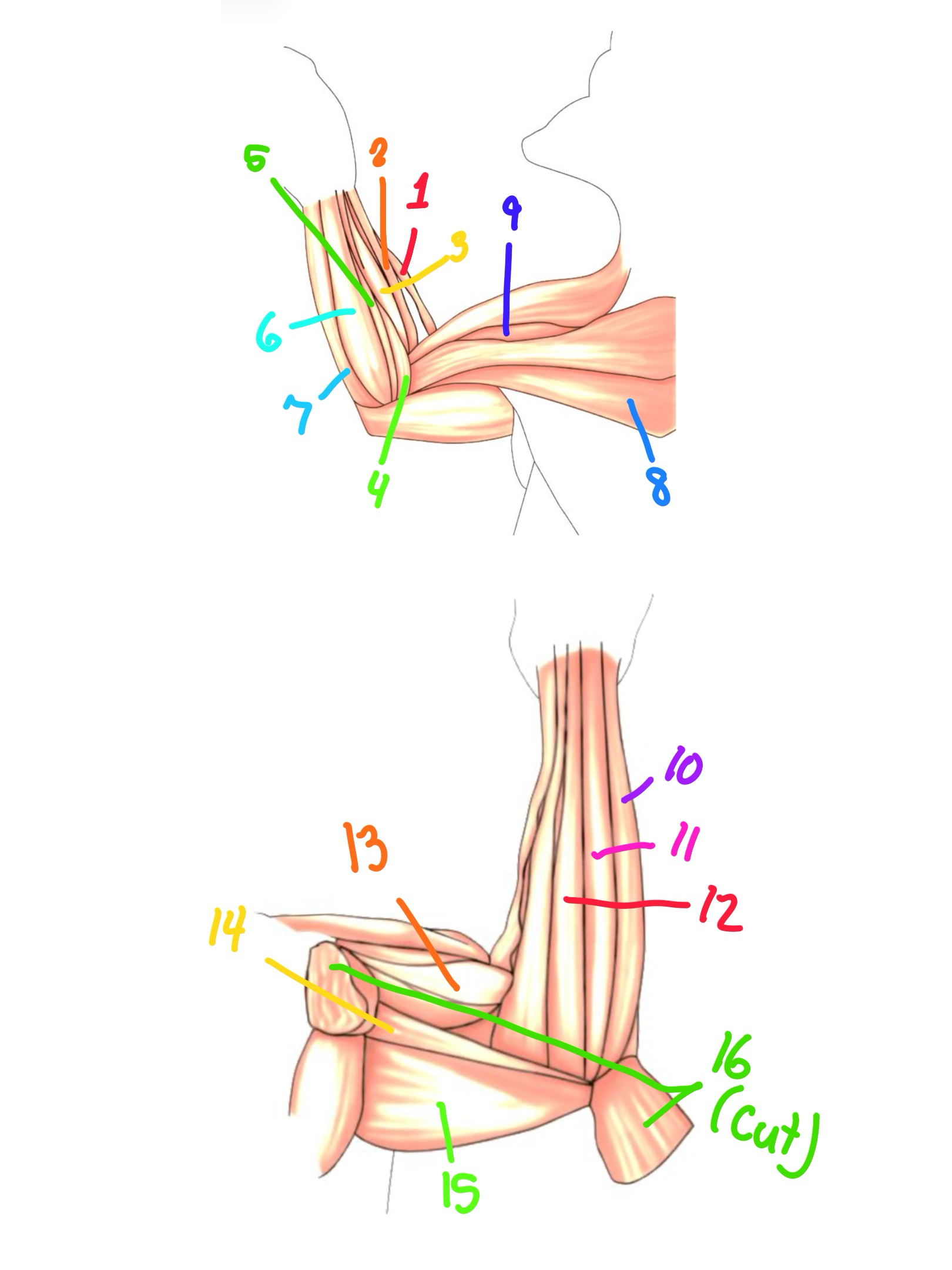 <p>Pectoralis Major</p>
