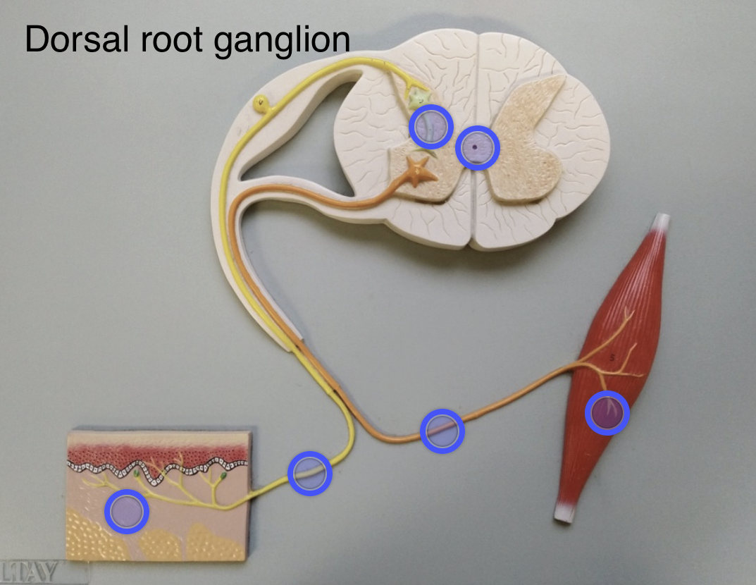 <p>Houses sensory neuron cell bodies</p>