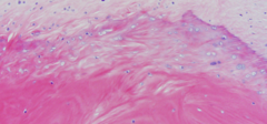 <p>What type of cartilage is this?</p>