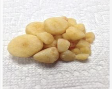 <p>Which type of canine calculi is seen in this image and is the historically most common crystal in dogs?</p>