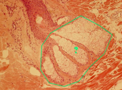 <p>identify the indicated structure of the integument</p>
