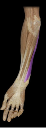<p>What the highlighted structure is acting on the <strong><mark data-color="#ffdb9c" style="background-color: rgb(255, 219, 156); color: inherit;">Wrist and Hands</mark>.</strong> What muscle is this called?</p>