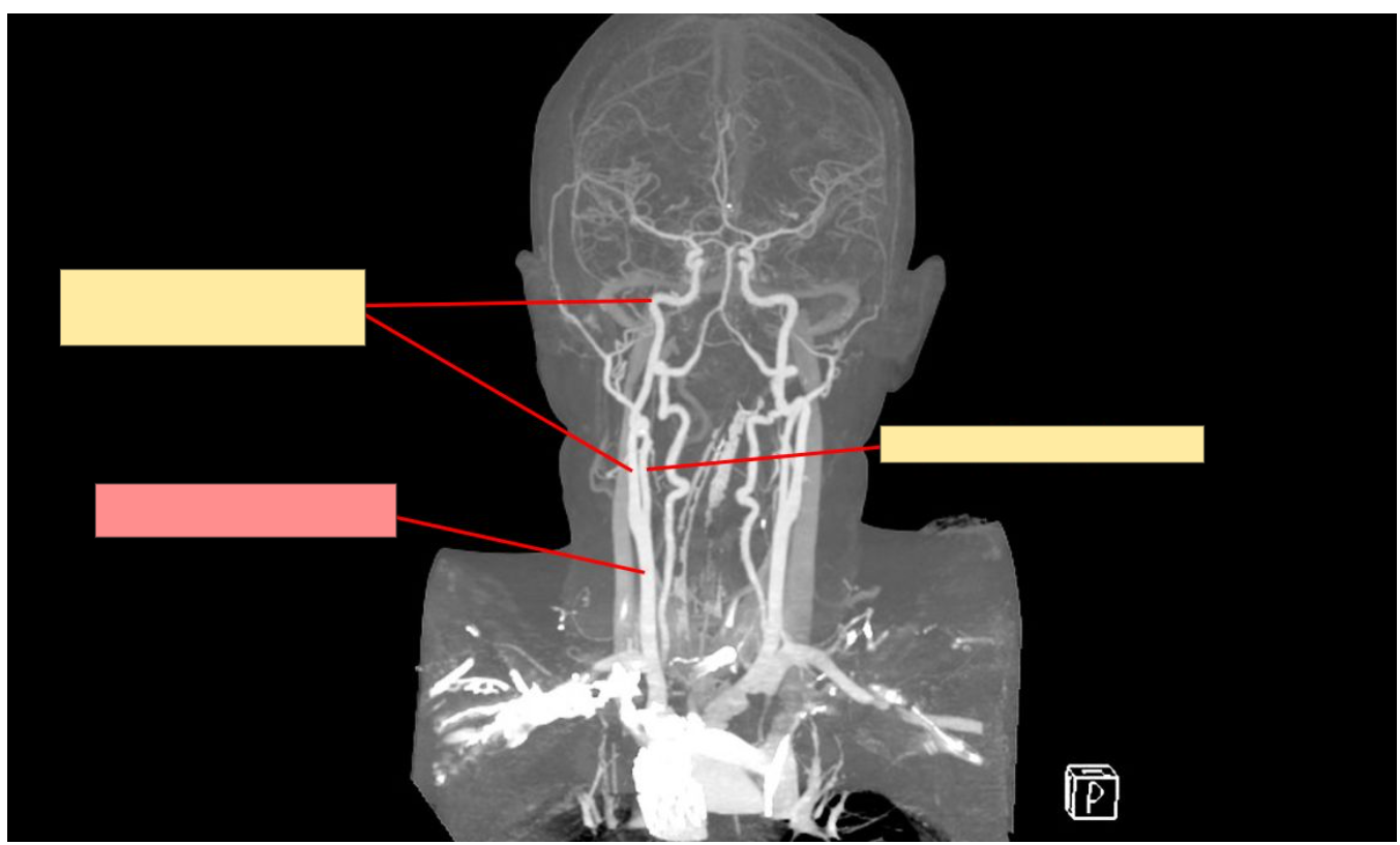 <p>Name this structure</p>