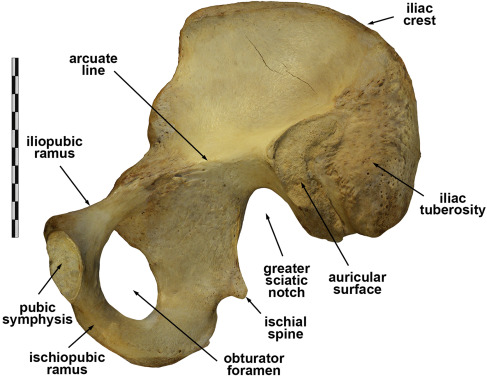 <p>Pelvis: What side is this</p>