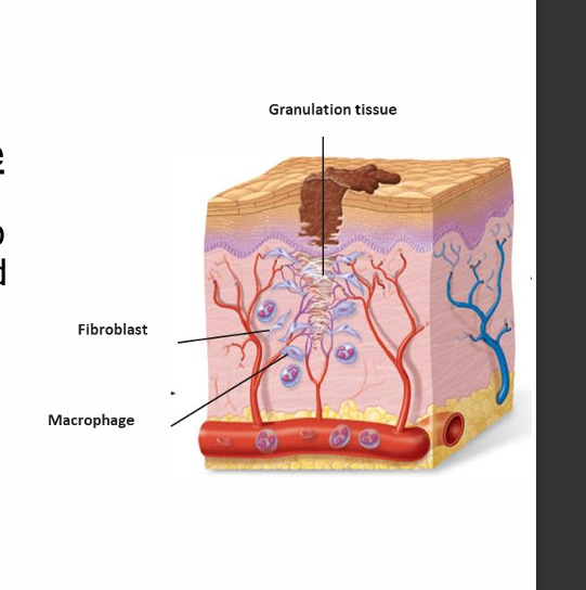 <p><strong>Epithelialisation</strong></p><ul><li><p>Stem cells <strong>multiply</strong></p></li><li><p><strong>Migrate over granulation tissue</strong></p></li><li><p>Begin to restore the epidermal surface</p></li></ul><p></p>