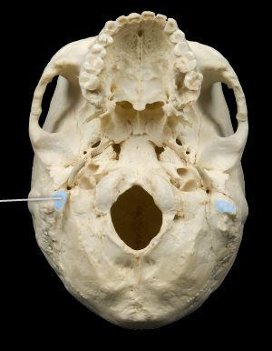 <p>What feature of the skull is this? </p>
