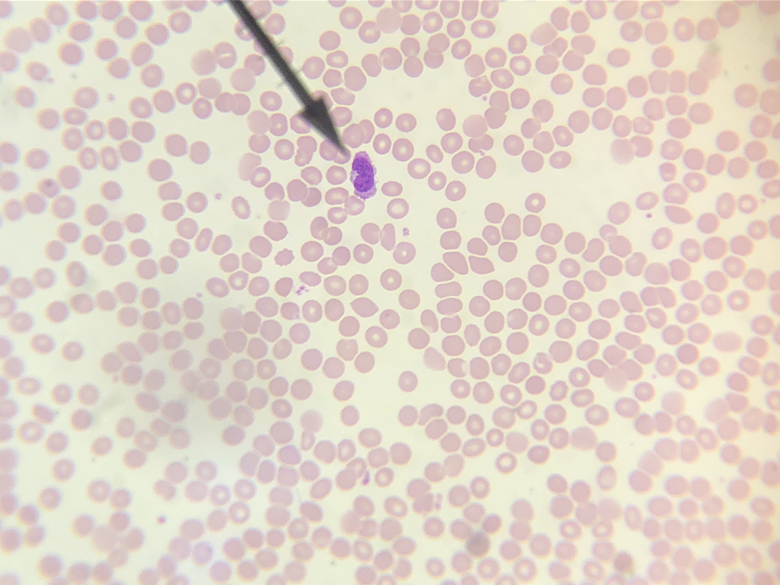 <p>This one (above) is a little weird, but you should still be able to identify the formed element at the tip of the pointer.</p>