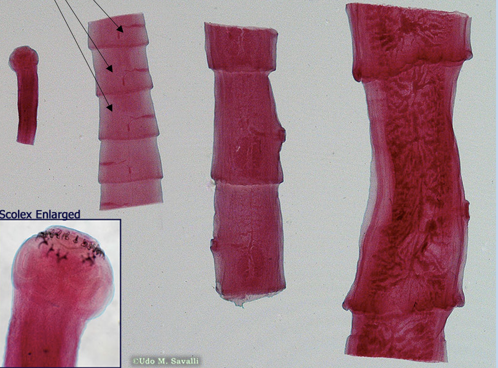 <p>A part of the platyhelminthes phylum </p><p>These are parasitic and choose vertebates as hosts, living in their intestines and absorbing pre-digested nutrients</p><p>*Pay close attention to shape compared to other flatworms: pink stain, distinct <strong>proglottid</strong> segments (what arrows are pointing to, these are hermaphroditic/containing both sperm and egg, and break off once fertilized to become new worms), scolex with spiked opening </p>