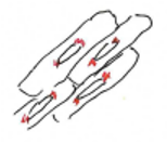 <p>Oldhatatlan, barnássárga, granuláris kopási pigment, intracytoplasmatikusan és perinukleárisan (“sapkaszerűen”) jellemző)</p><p>Főleg idős korban, senyvesztő betegségekben, cachexiánál, daganatos megbetegedésekben</p><p>Lipidek és fehérjék komplexe: subcelluláris membránokból, szabadgyökös lipidperoxidáció miatt -› mutatja mennyi ROS érte az adott szövetet</p><p>Atrophia brunea cordis</p><p></p>