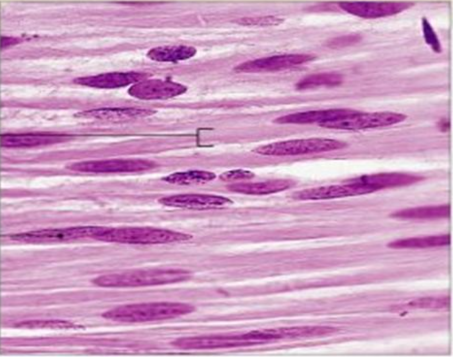 <p>Smooth Muscle Tissue </p>