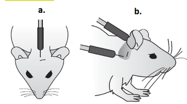 <p><span style="background-color: transparent;">Auditory-evoked brainstem response (ABR)</span></p>