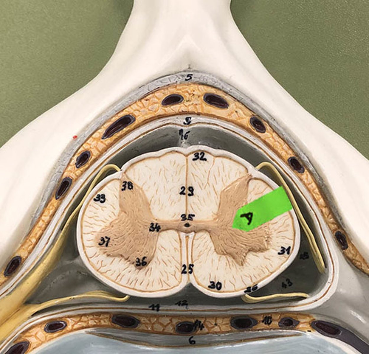 <p>Identify the general name for this darker nervous tissue.</p>