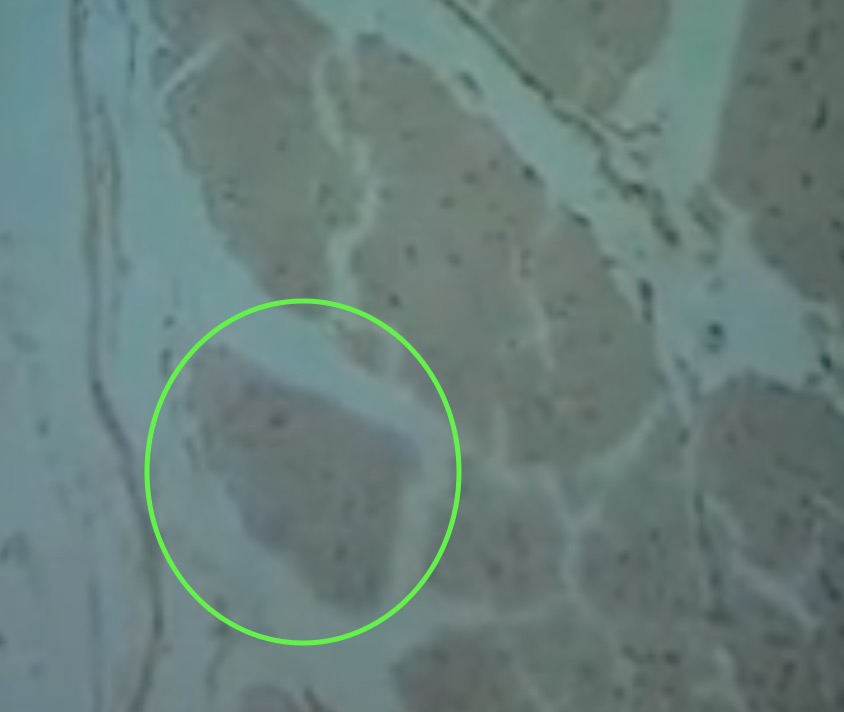 <p>Group of muscle fibers</p>