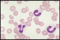 <p>An immature white blood cell with a curved, unsegmented nucleus shaped like a U, C, or horseshoe</p>