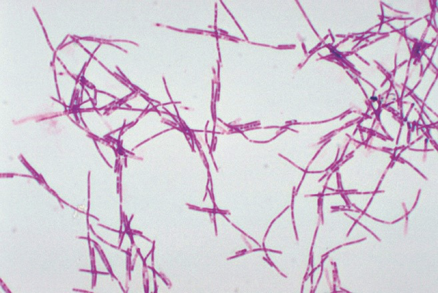<p>What type of organism is Bacillus anthracis</p>