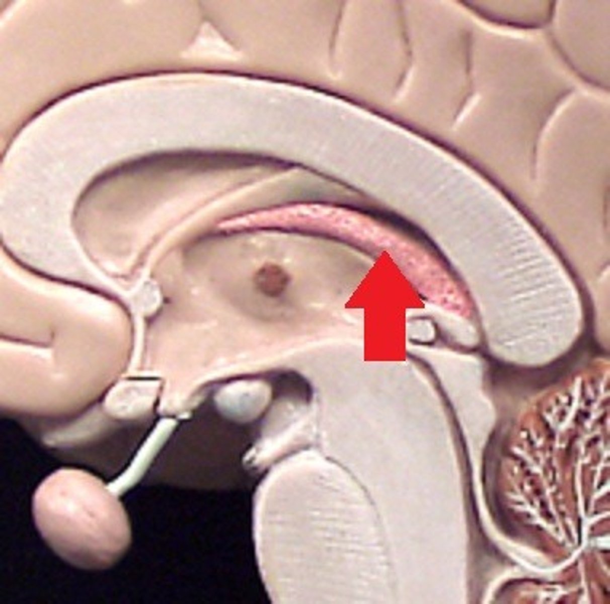 <p>secretion spinal fluid</p>