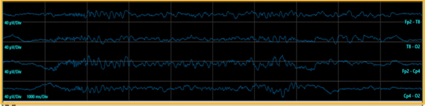 <p>What is this pattern referred to as? </p>