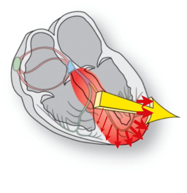 <p>Left and inferiorly</p>