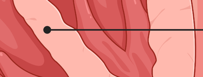 <p>What is this part of the heart?</p>
