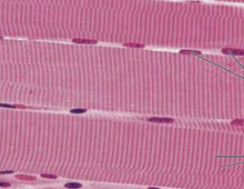 <p>what tissue is this</p>