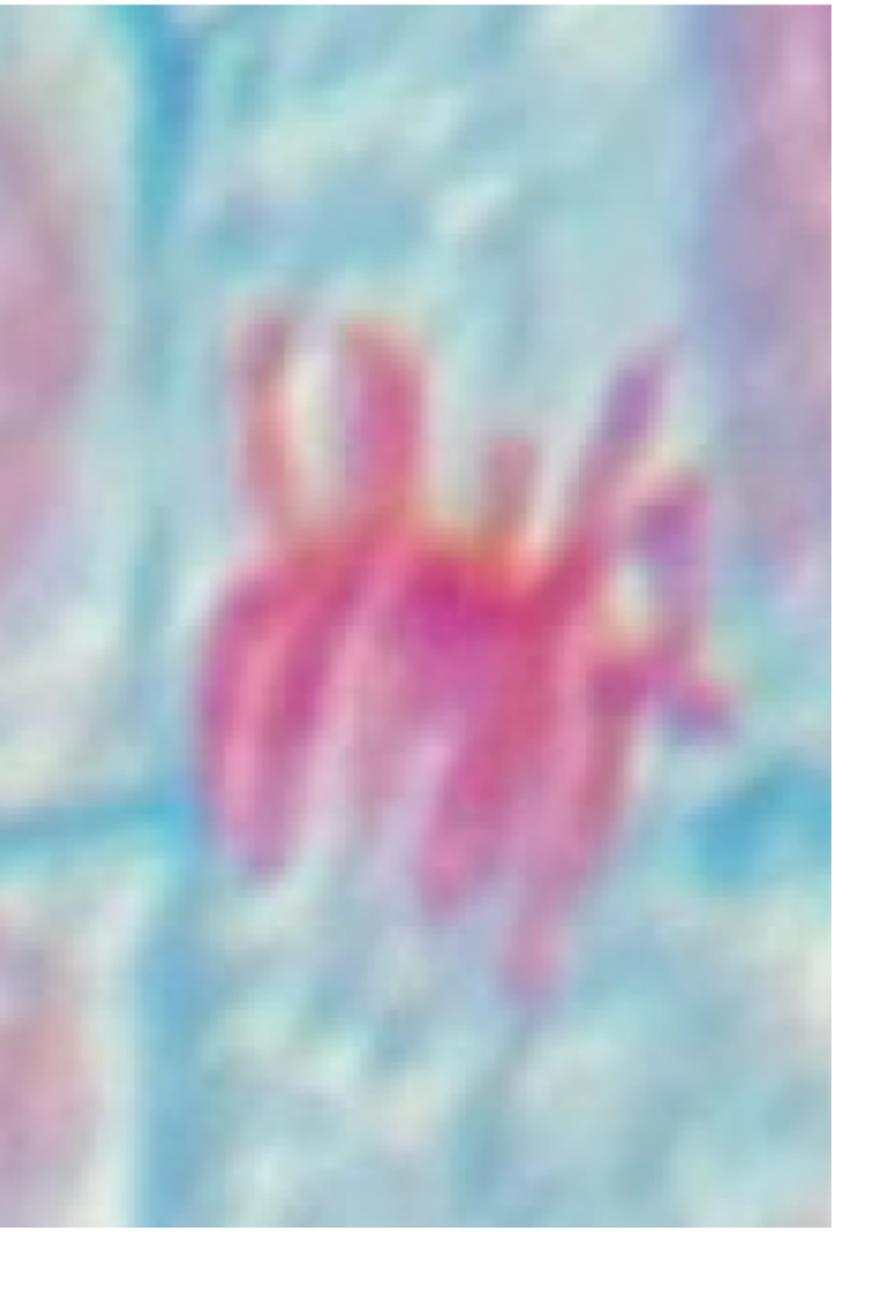 <p>What phase of mitosis is this?</p>