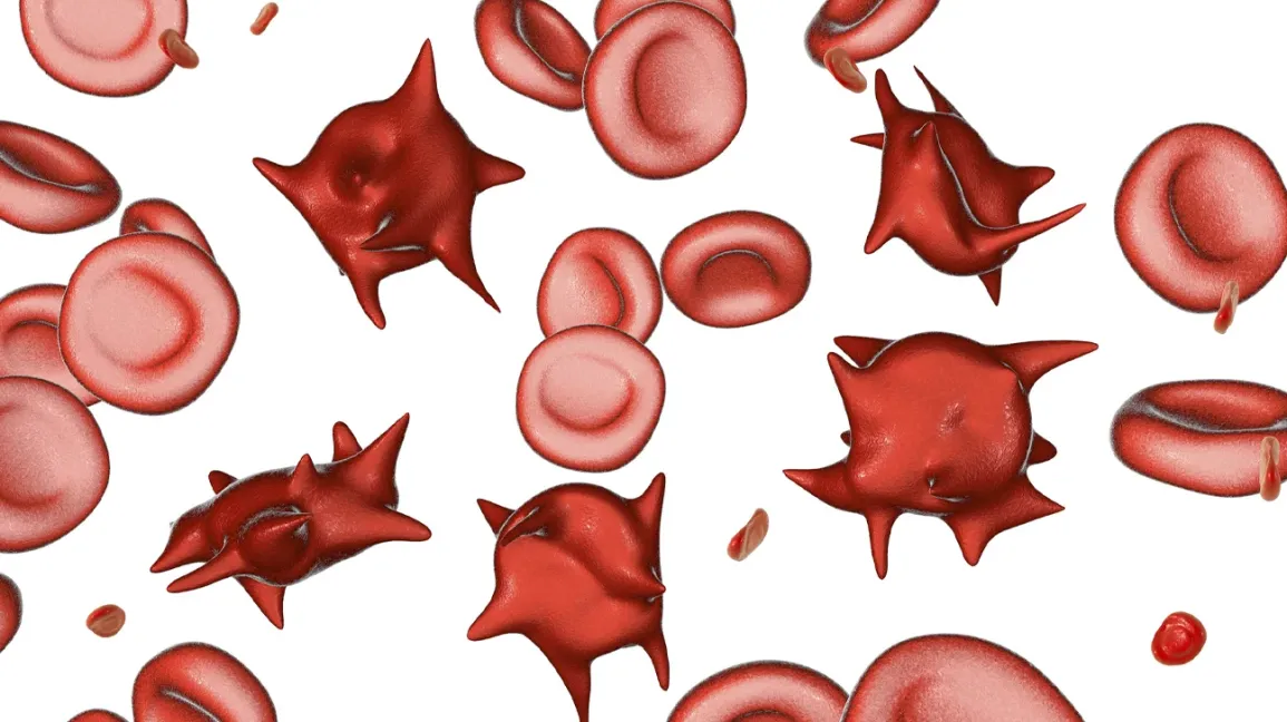 <p>Acanthocyte </p>