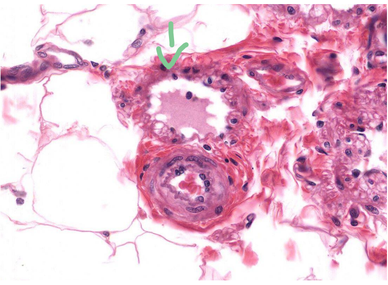 <p>Identify the vessel indicated by the arrow</p>