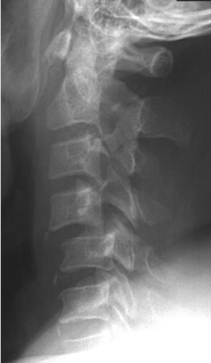 <p>What is the finding &amp; diagnosis?</p>
