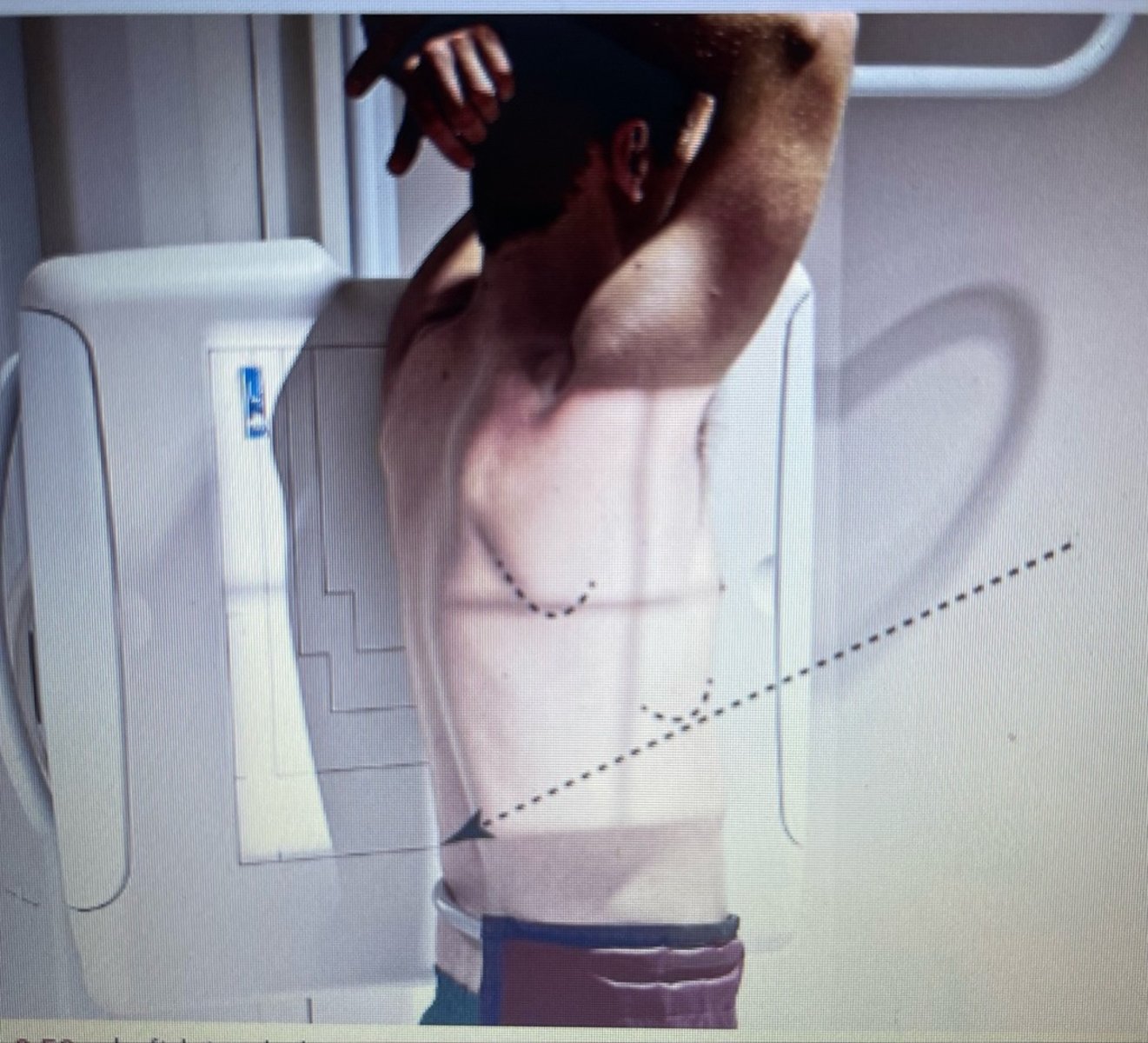 <p>- What exam is this?</p><p>- What is the SID?</p><p>- Is the patient shielded?</p><p>- How is the patient positioned?</p><p>- Why is the patient positioned on their left side?</p><p>- What is the CR?</p><p>- What are the breathing instructions?</p><p>- What is the anatomy demonstrated?</p>