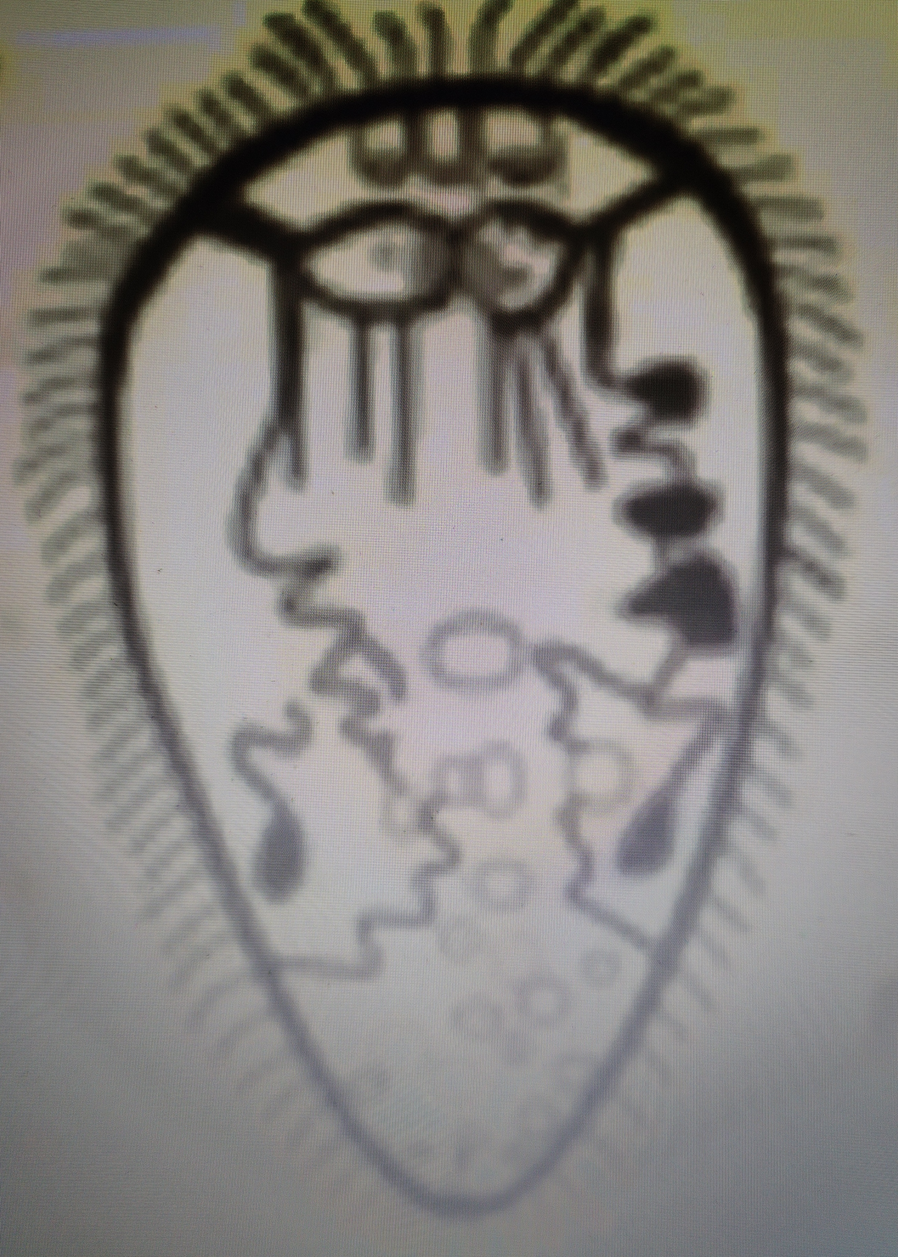 <p>Identify the stage</p><p class="has-focus">A. Sporocyst</p><p class="has-focus">B. Cercaria</p><p class="has-focus">C. Miracidium</p><p class="has-focus">D. Metacercaria</p>