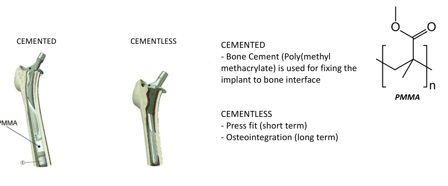 <p>cemented: bone cement is used for fixing the implant to bone interface</p><p>cementless: press fit (short term), osteointegration (long term)</p>
