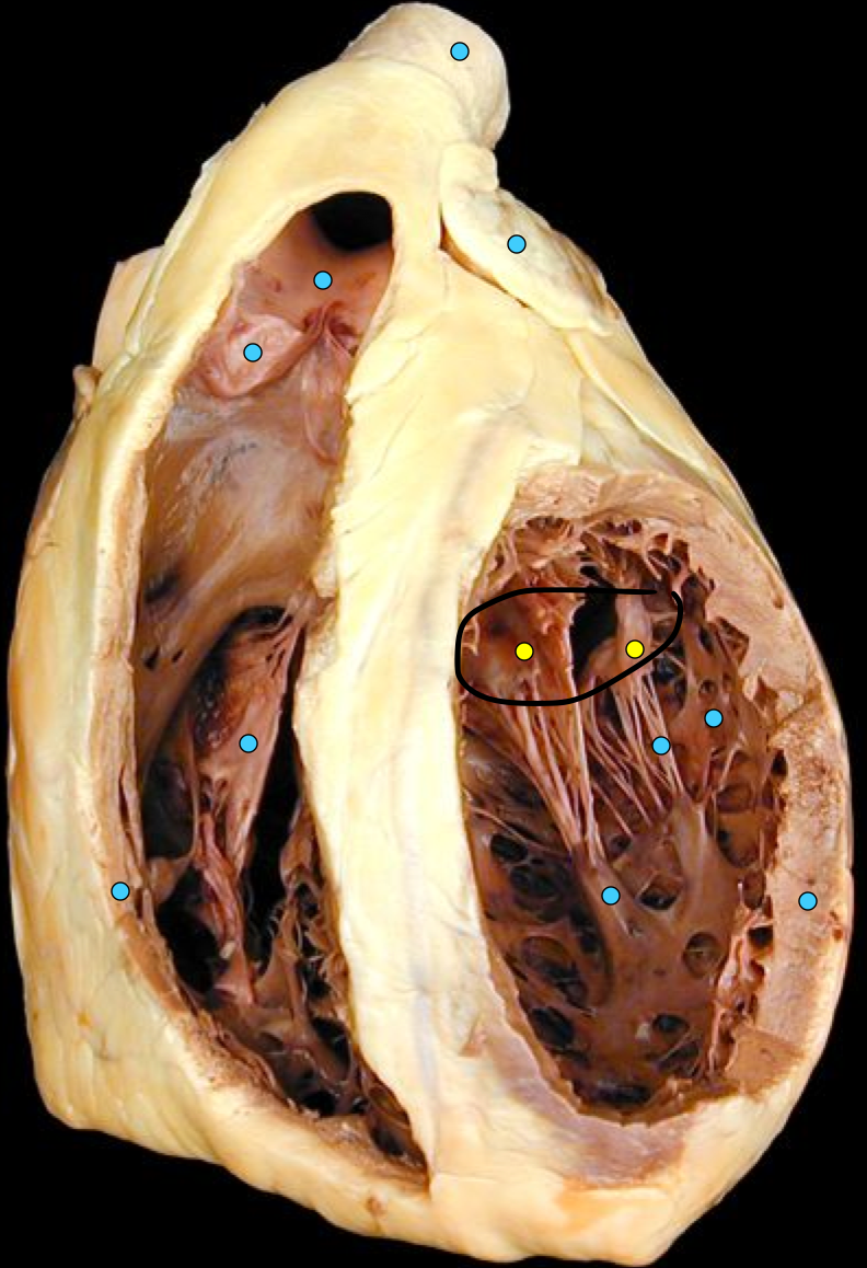 term image