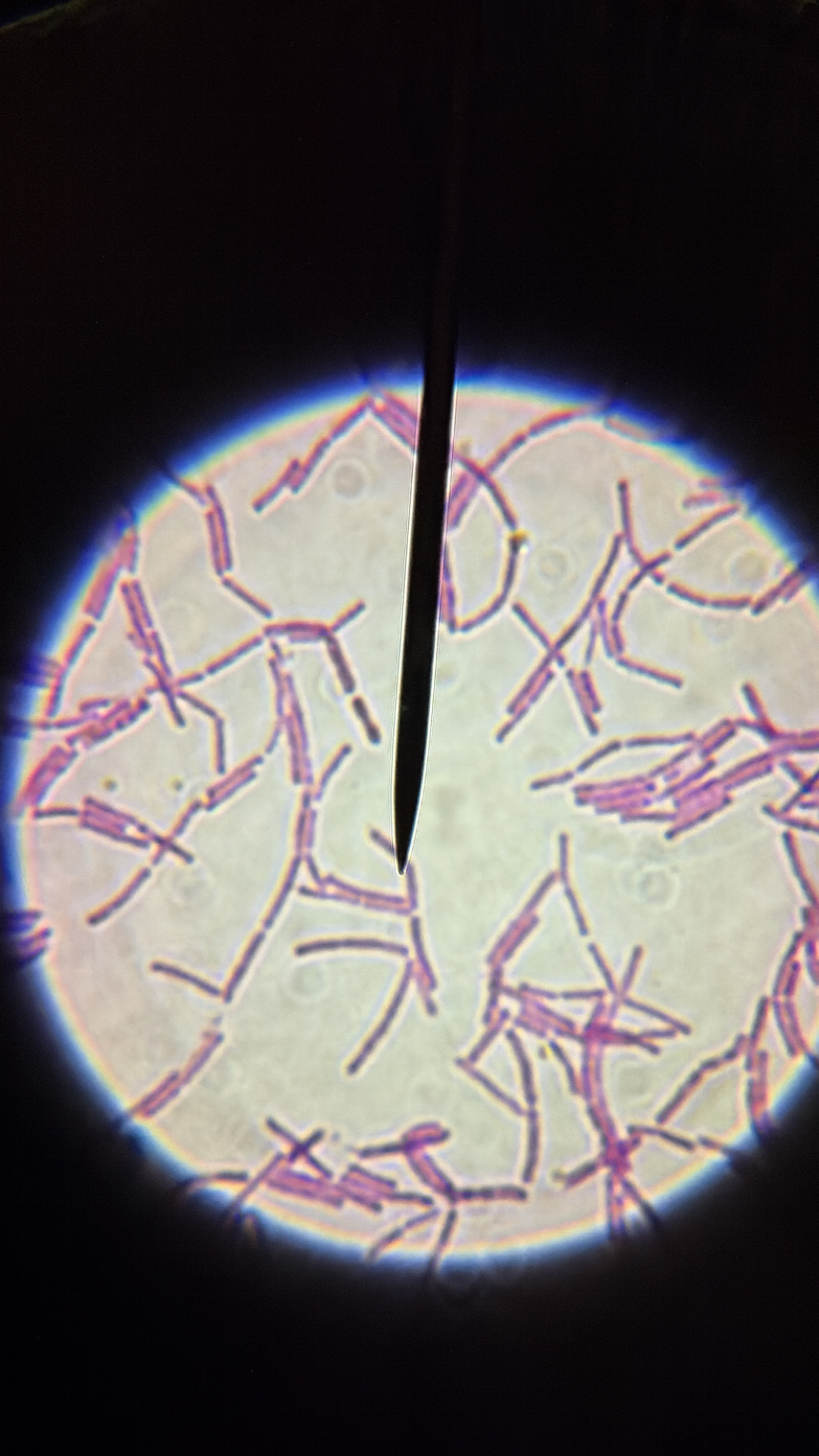 <ol><li><p>This slide shows a/an:</p></li></ol><p class="p1">a) Prokaryotic cell</p><p class="p1">b) Eukaryotic cell</p><p class="p1">c) None of the above</p><ol start="2"><li><p class="p1">Which type of cells does this slide show?</p><p class="p1">a) Cocci cells</p><p class="p1">b) Bacilli cells</p><p class="p1">c) Spirilli cells</p><p class="p1">d) None of the above</p></li></ol><ol start="3"><li><p class="p1">Which type of cell does this slide show an example of:</p></li></ol><p class="p1">a) Spirogyra</p><p class="p1">b) Volvox</p><p class="p1">c) Diatoms</p><p class="p1">d) None of the above</p><ol start="4"><li><p class="p1">Which type of cell does this slide show an example of:</p><p class="p1">a) Amoeba</p><p class="p1">b) Paramecium</p><p class="p1">c) None of the above</p></li><li><p class="p1">Which type of cell does this slide show an example of:</p><p class="p1">a) Archaebacteria or Eubacteria</p><p class="p1">b) Plantae</p><p class="p1">c) Protista</p><p class="p1">d) Fungi</p><p class="p1">e) Animalia</p></li></ol><p class="p1"></p><p class="p1"></p>