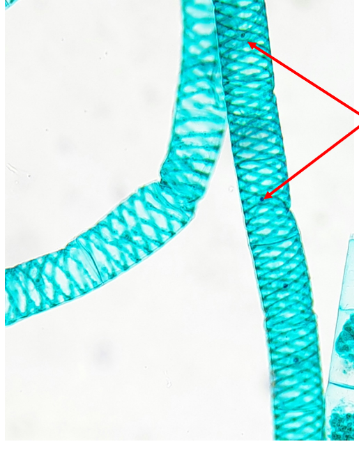 <p>Protista</p>