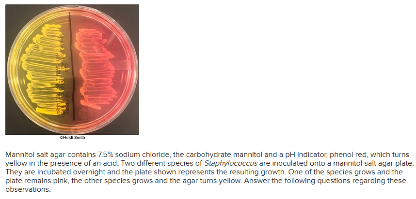 <p><span>Some organisms ferment certain carbohydrates to produce an acidic byproduct while others don’t. What component of mannitol salt agar makes this media differential?</span></p>